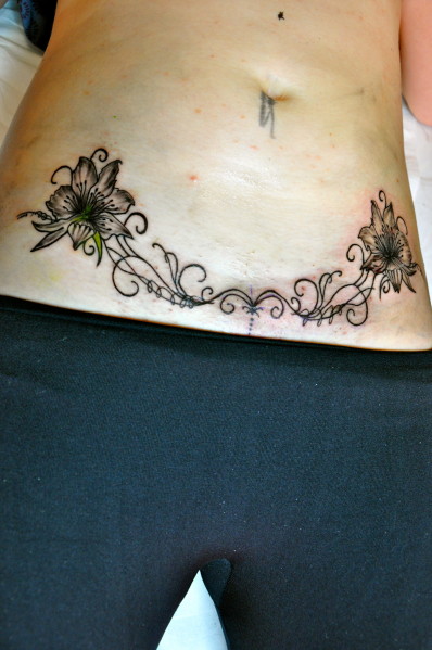 tatouage cicatrice ventre