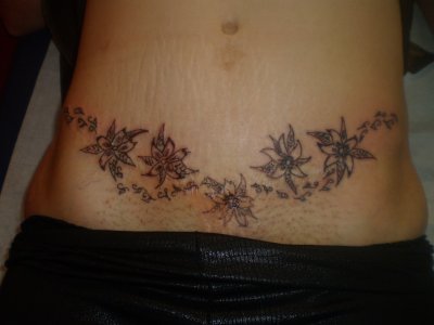 tatouage cicatrice ventre