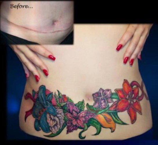 tatouage ventre cesarienne
