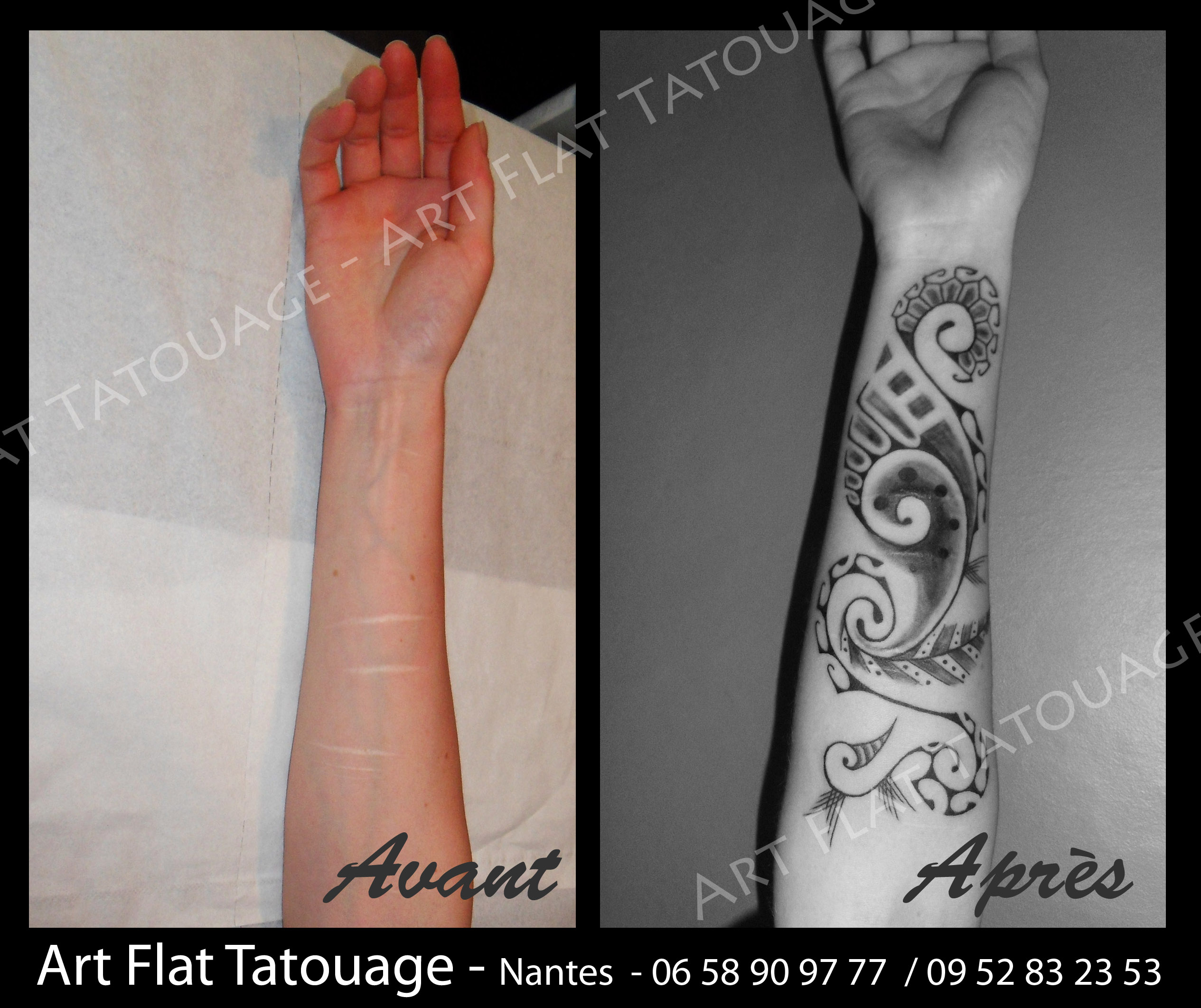 tatouage ventre cicatrisation