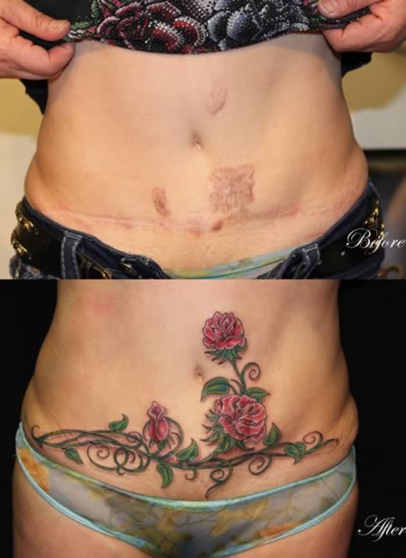 tatouage ventre cicatrisation