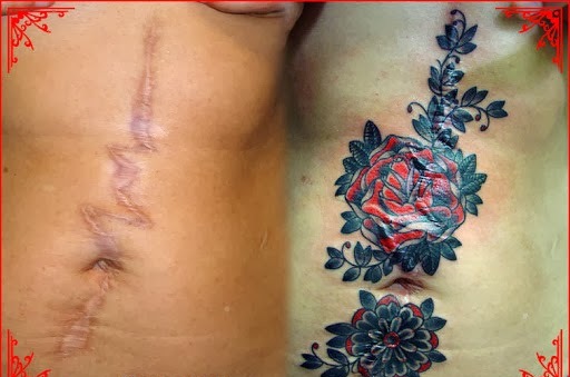 tatouage ventre cicatrisation